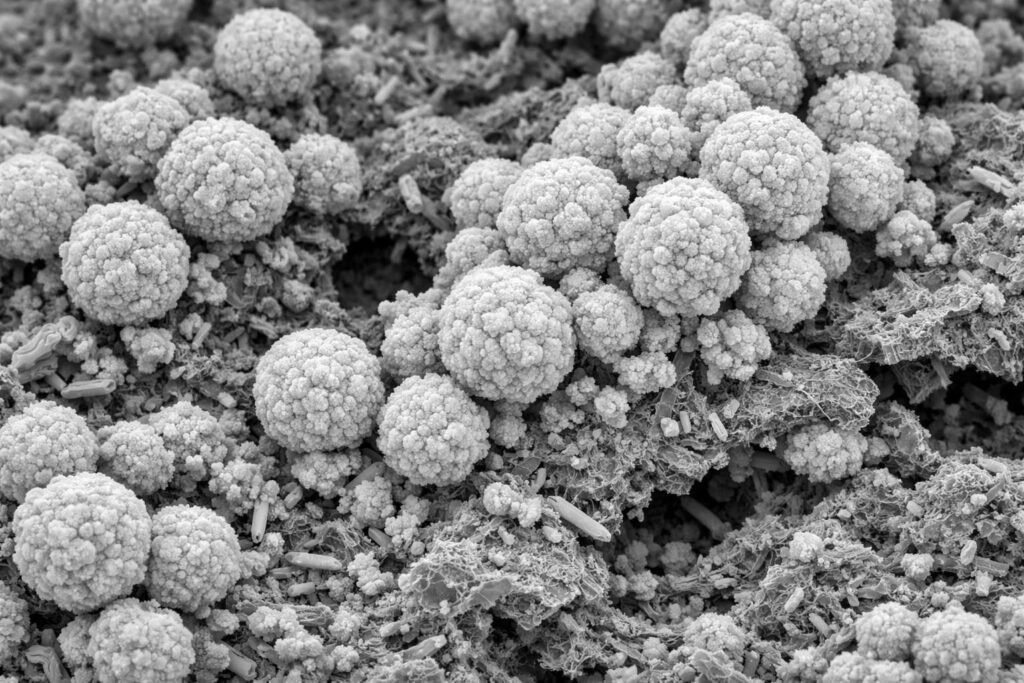 Microscopic view of apatite mineral formation on bioactive nanocomposite surfaces.